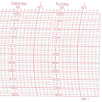 Metcheck MB1 Barograph Chart