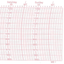 Metcheck MB1 Barograph Chart