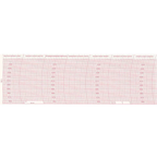Metcheck W1 Barograph Chart